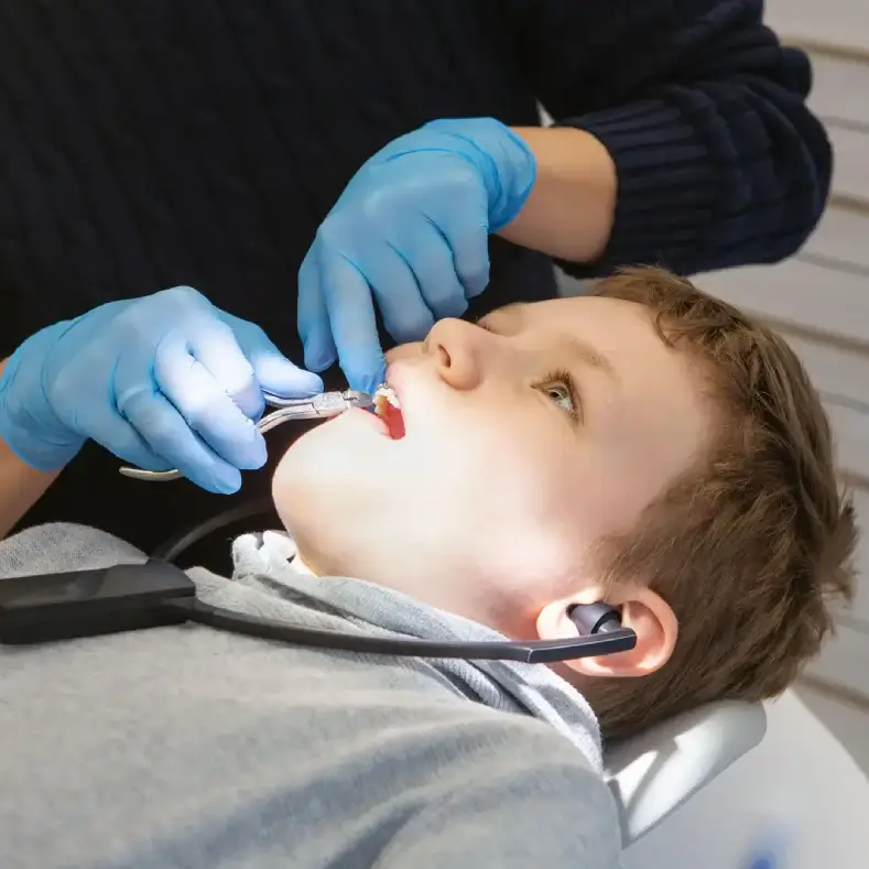 early-orthodontic-treatment-second-rowside-round-image