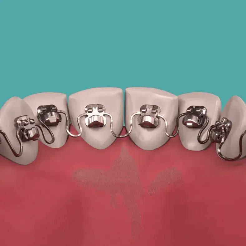 inbrace-second-row-side-round-image