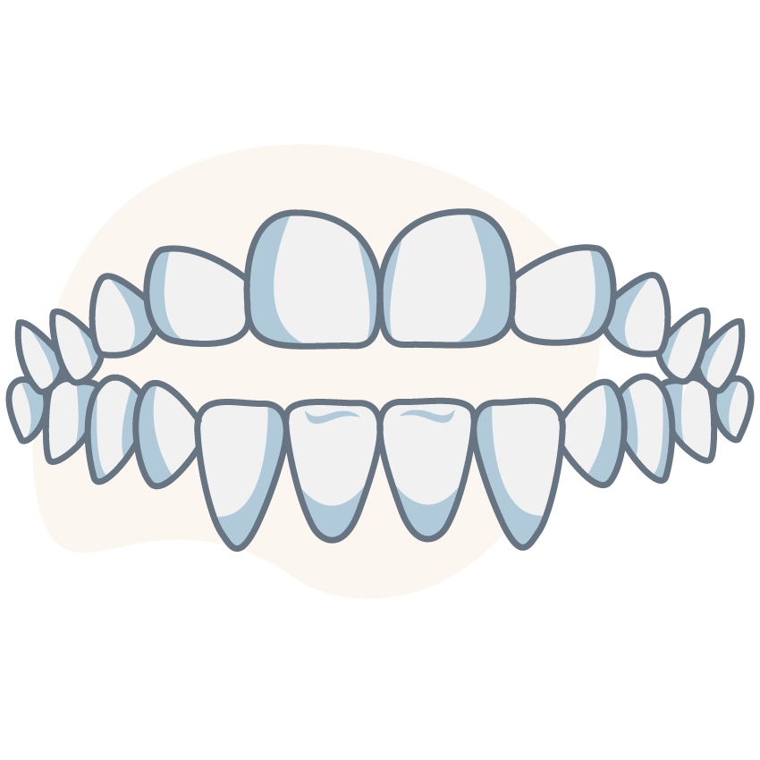 open-bite-side
