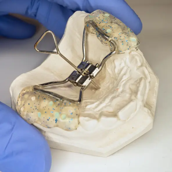 palatal-expander-top