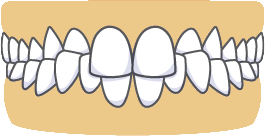 crossbite-back